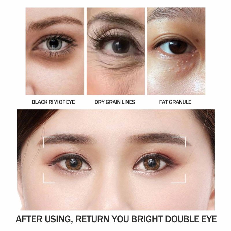 Eye Cream Manufacturer - EELHOE Improves Fine Lines Tightens Eye Bags