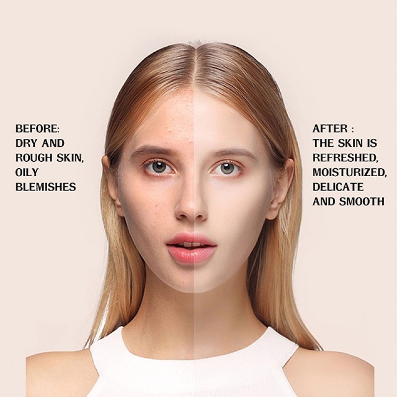 Facial Serum Factory - OEM Private Label Niacinamide Vitamin C Whitening