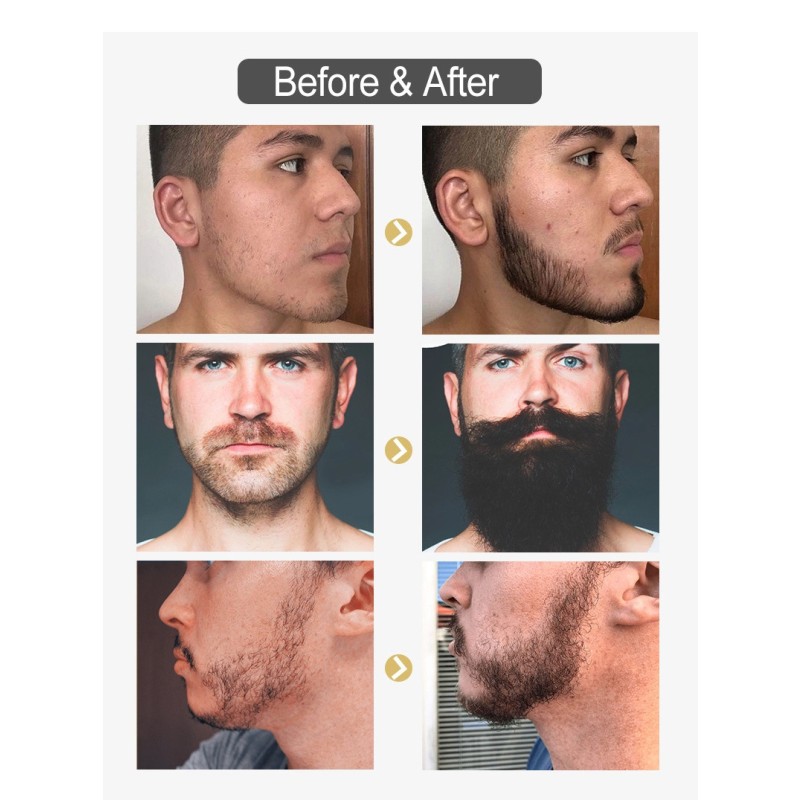 Beard Oil Manufacturer - Hot Wholesale 30ml Private Label Best