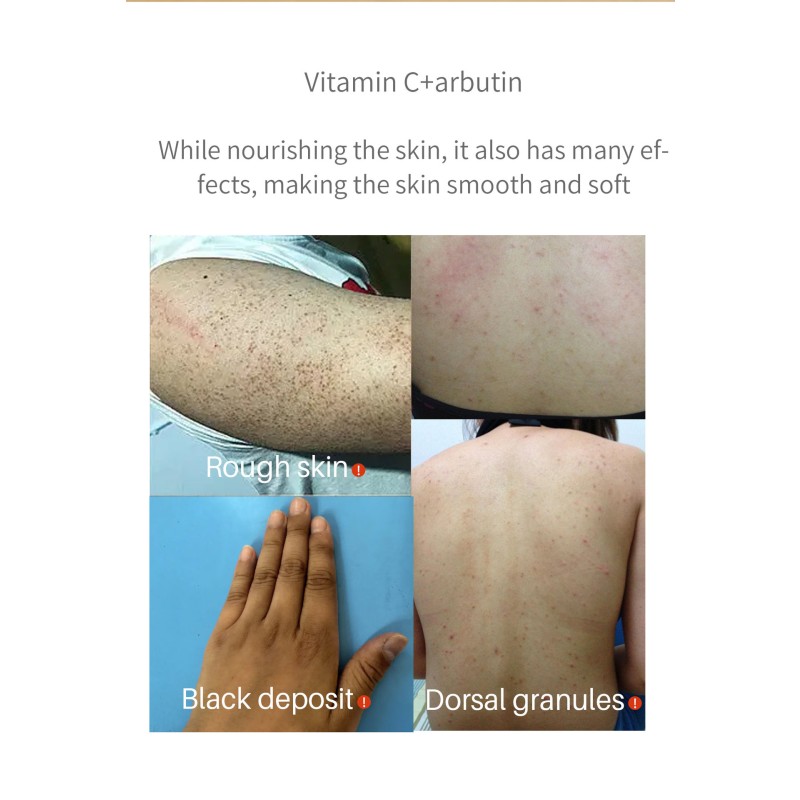 Body Lotion Supplier - Brightening Moisturizing Body Mist Set