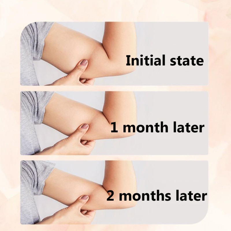 Hot Sale Make Body Curve More Prominent Containing Whitening Skin Anti-Aging Lose Weight Apple Cider Vinegar Capsule