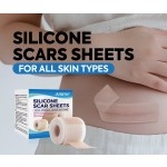 Silicone Scar Sheet