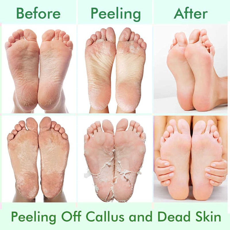 Foot Peeling Mask Factory - Dead Skin Removal Callus