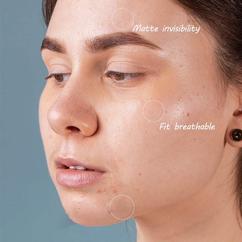 Acne Treatment Patch Factory - Hydrocolloid Spot Dots