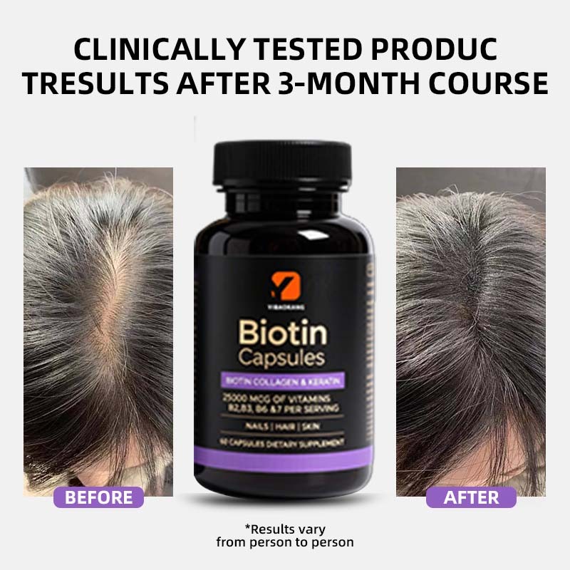 Biotin Collagen Keratin Supplement Supplier - 25000mcg Hyaluronic Acid