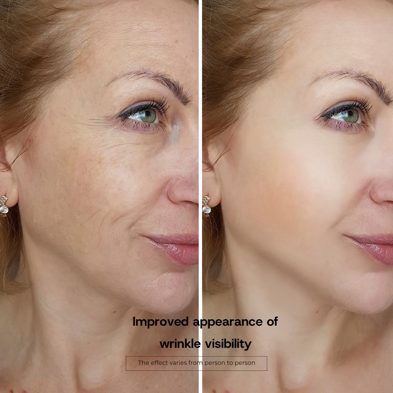 Collagen Hydrolyzed Powder Factory - Skin Firmness Joint