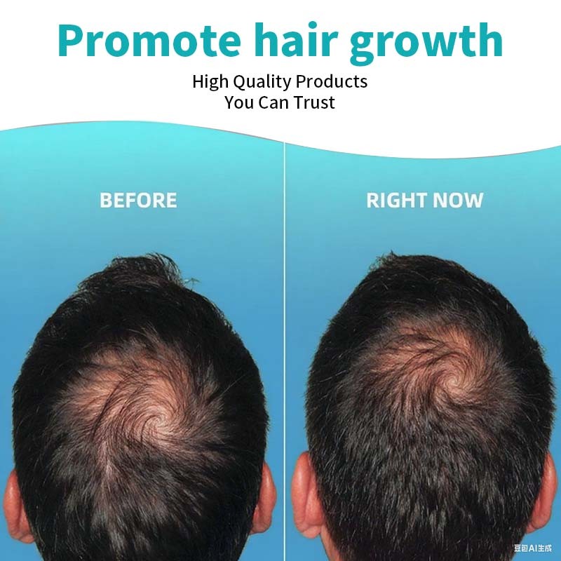 Biotin Collagen Hair Oil Supplier - 4oz Hair Growth Beauty