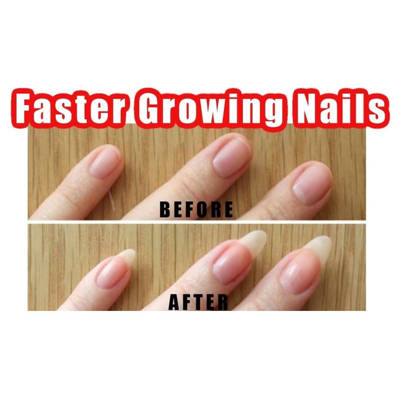 Biotin Gummies Supplier - Vitamin B7 Hair Skin Nails