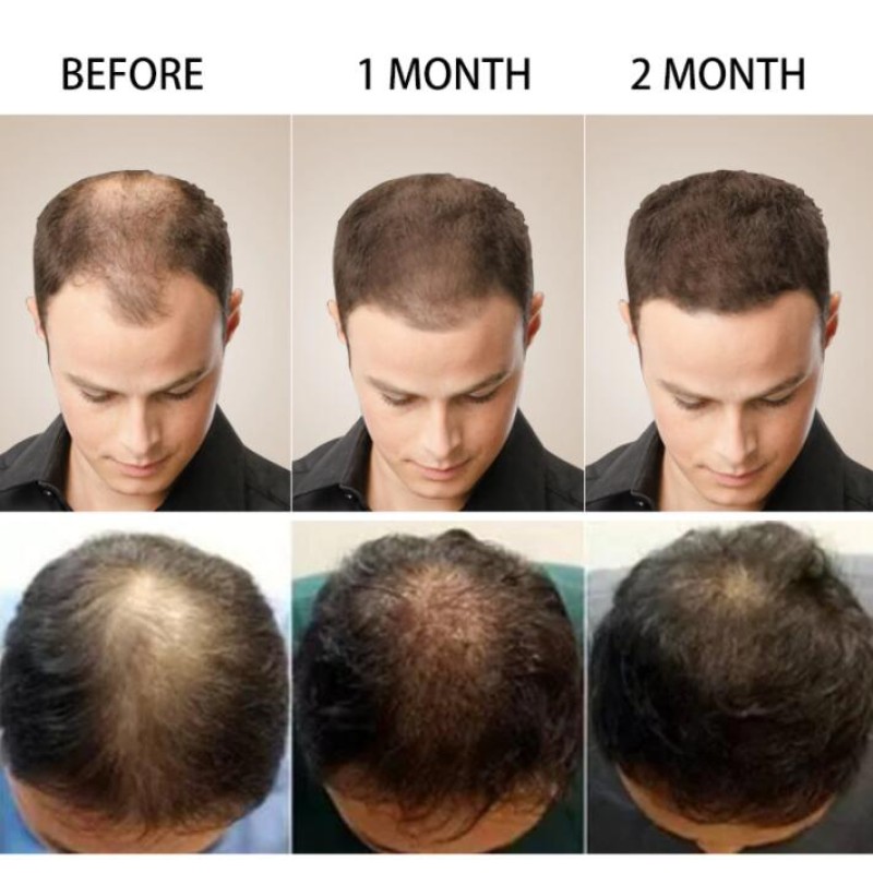 Biotin Gummies Supplier - Vitamin B7 Hair Skin Nails