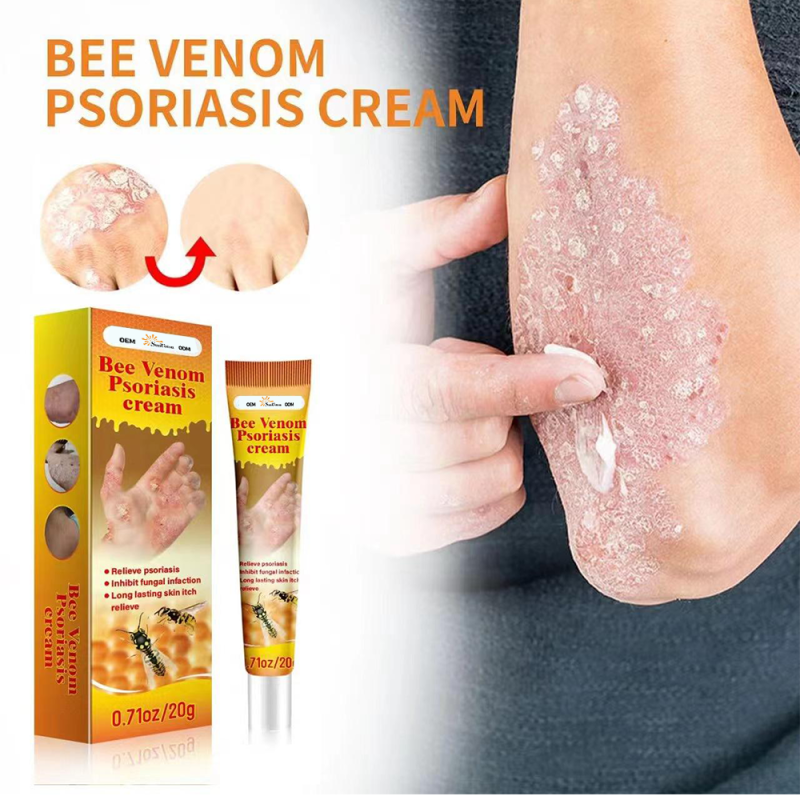 Psoriasis Cream Manufacturer - Natural Repair Antibacterial