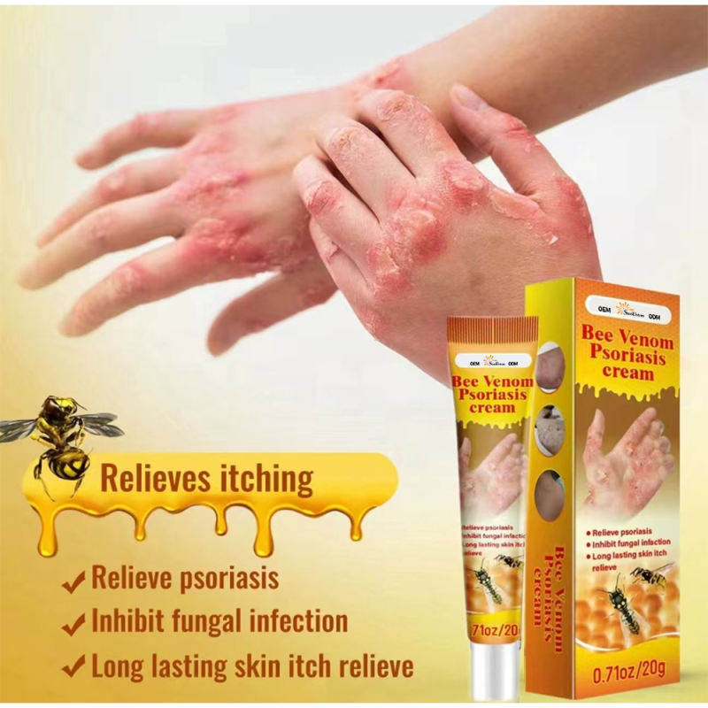 Psoriasis Cream Manufacturer - Natural Repair Antibacterial