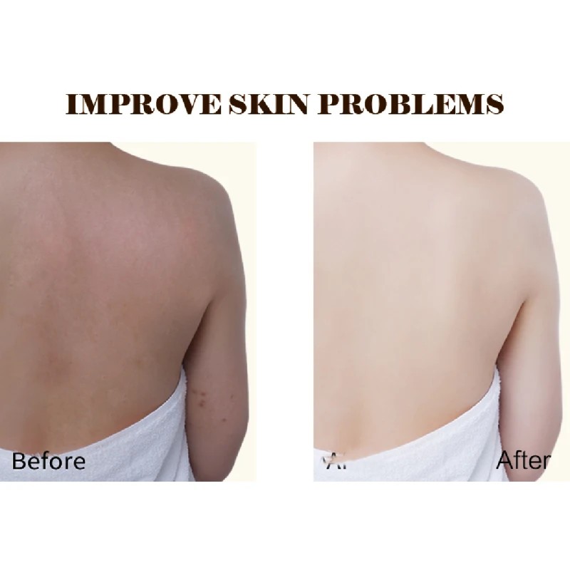 Skin Whitening Softgels Factory - US Private Label Collagen