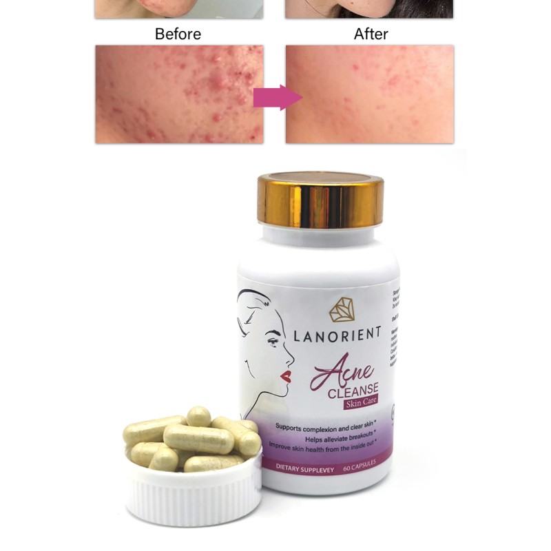 Teen Acne Supplement Manufacturer - Fish Oil Vitamin Antioxidant