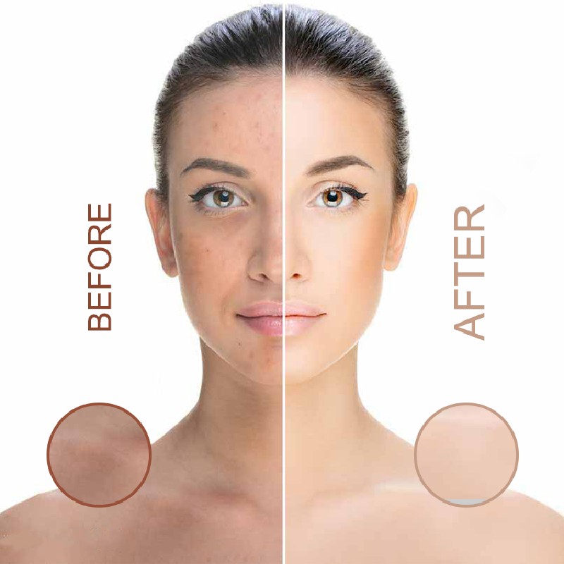 Anti-Aging Softgels Supplier - 8-in-1 Liposome Glutathione