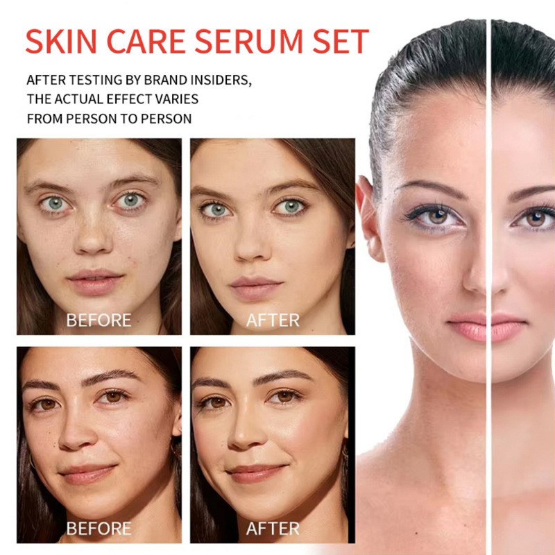 Laundry Beads Manufacturer - 3in1 Concentrated Pods