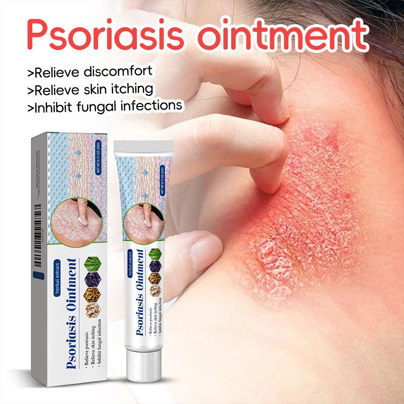 Psoriasis Ointment Factory - Herbal Formula Deep Repair Itching Relief
