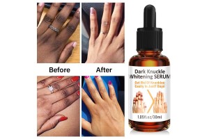 12-Year Expert Cosmetics OEM Partner: Tailored Whitening Serum Solutions to Unlock Local Whitening Market Opportunities