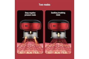 Elevate Your Wellness Brand with Jining Shenghao’s OEM/ODM Electric Cupping Machines