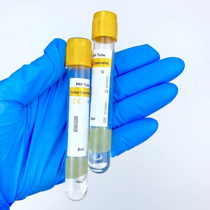 Platelet-Rich Plasma(PRP)