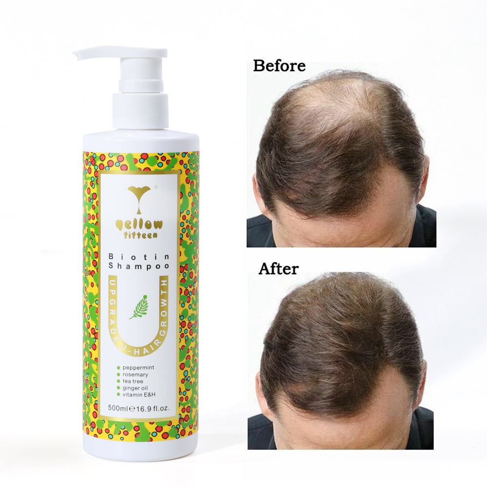Hair Loss Treatment