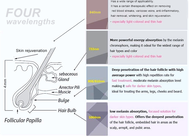 2.755nm 808nm 1064 Diode Laser Hair Removal