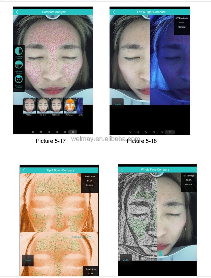 skin analyzer machine