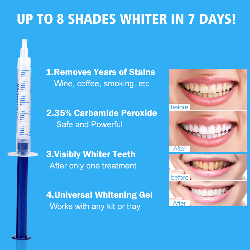Teeth whitening